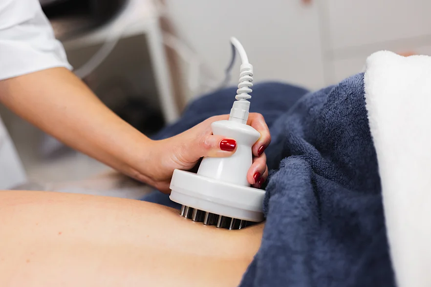 Cryolipolysis